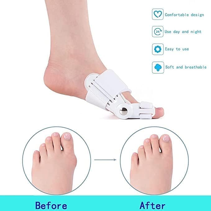 Bunion Corrector for Women Men, Orthopedic Toe Straightener Splint with Fracture Support and Pain Relief, Adjustable Design for Right/Left Foot Alignment, White, 1