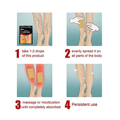 Veins Patches Dredge Vein Smoothing Varicose Veins Reduce Swelling Relieve Pain Instant Relief From Muscular Pain Improve Blood Circulation Skin Friendly (12pcs)