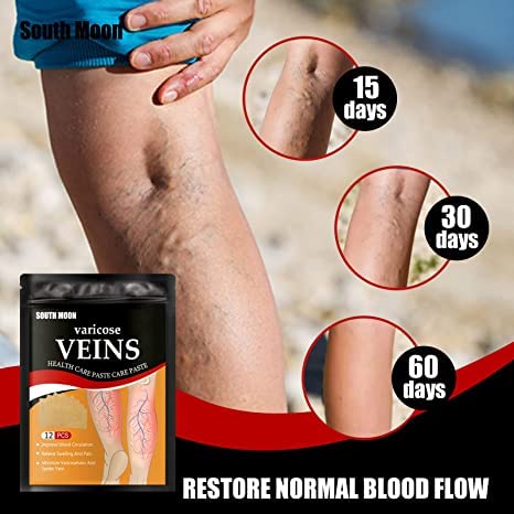 Veins Patches Dredge Vein Smoothing Varicose Veins Reduce Swelling Relieve Pain Instant Relief From Muscular Pain Improve Blood Circulation Skin Friendly (12pcs)
