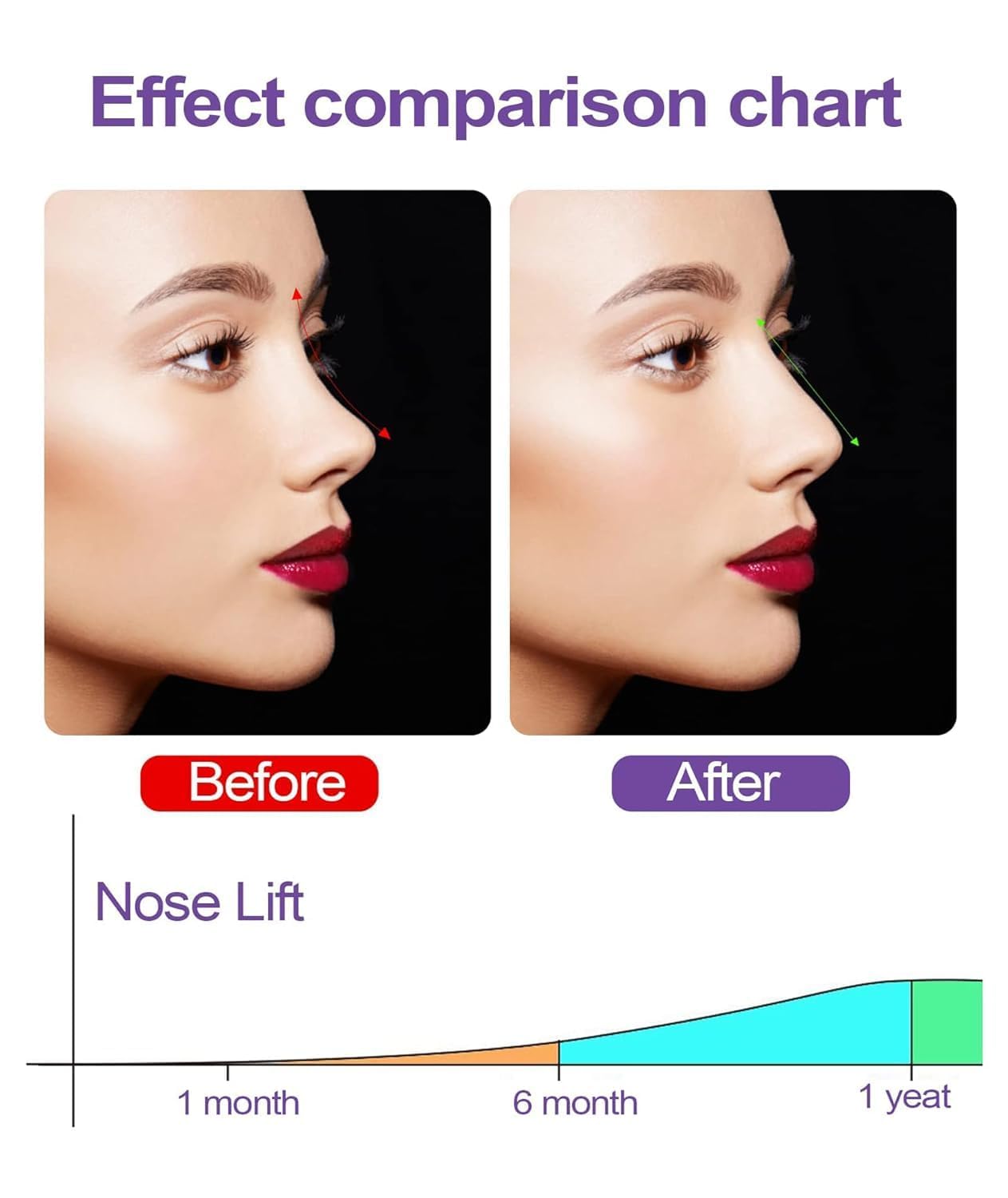 Silicone Nose Shaper Clip Nose Corrector Device for Nose Bridge Straightening and Lifting - Soft and Safe Non Surgical Nose Up Beauty Tool (Pack of-1)