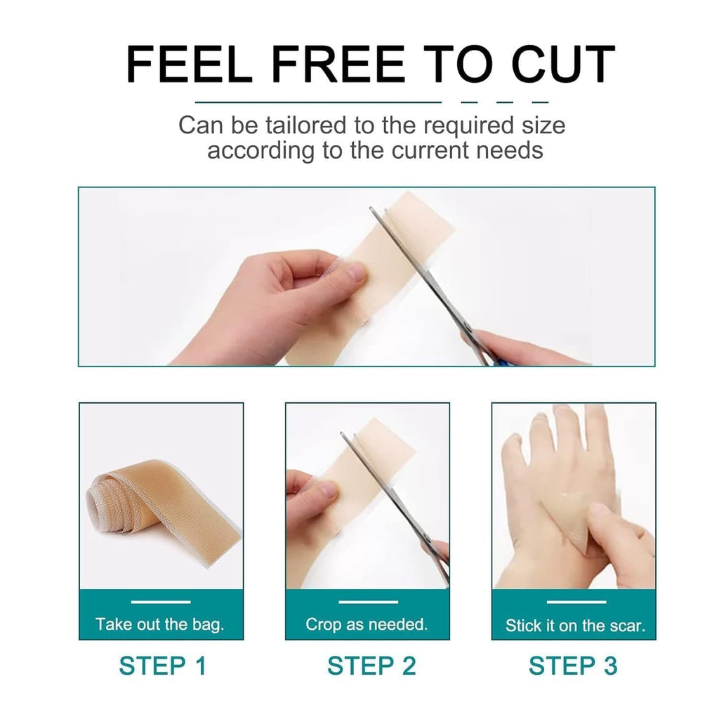 Silicone Scar Tape Scar Sheet - Upgrade Professional Medical Scar Removal Treatment, Non irritating, Painless for C-Section, Surgical Scars, Burn, Keloid, Acne(4cm x 150cm Roll)