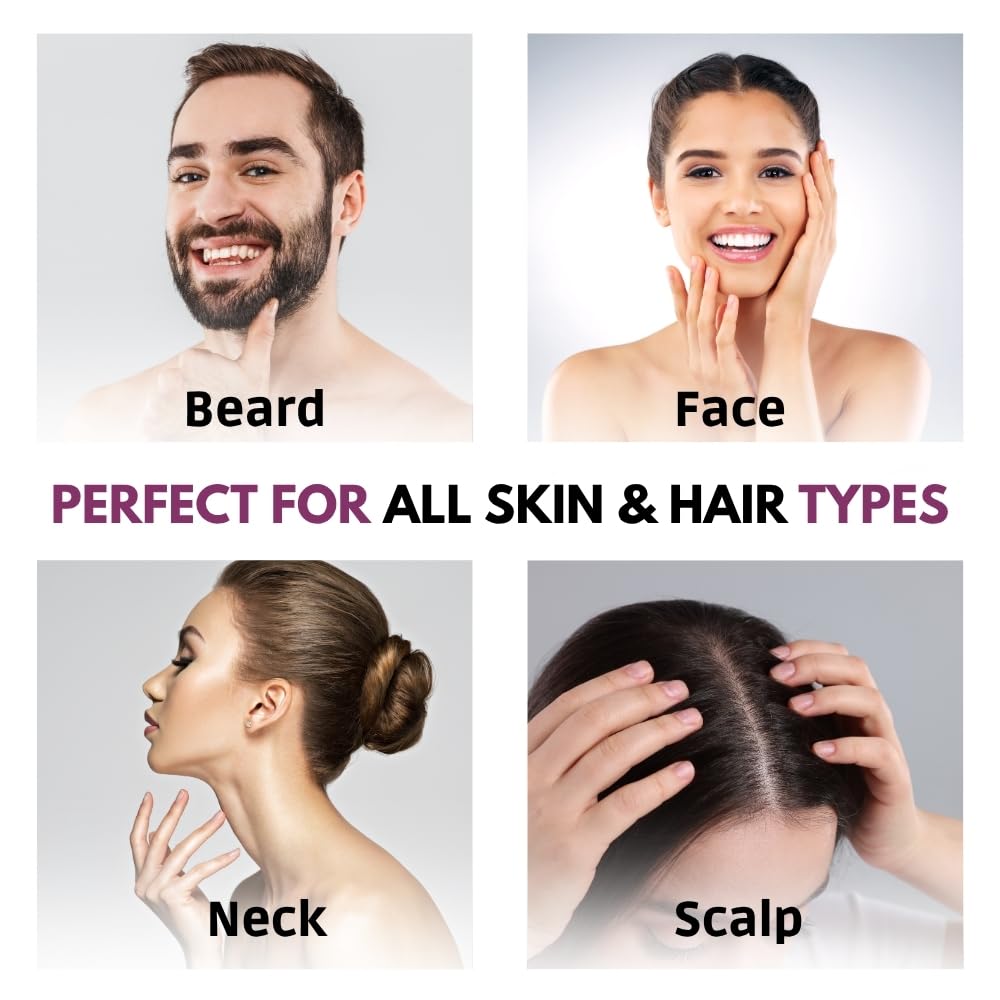 Derma Roller 0.5mm for Hair & Beard Growth – 540 Titanium Micro Needles for Hair Regrowth, Beard Growth, Acne Scar Reduction & Skin Rejuvenation – Safe for Men & Women (Black)